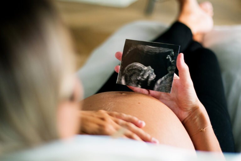 baby on ultrasound